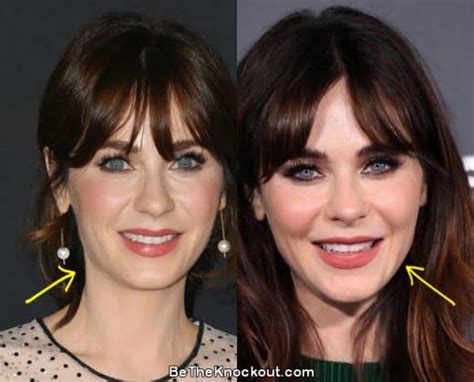 zooey deschanel facelift|Zooey Deschanel Before And After: Zooey’s。